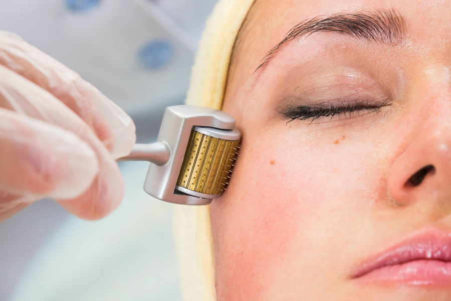 Angeli 18 – Lab. Pratico Microneedling